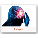 EPILEPSIE