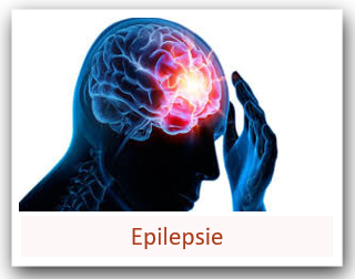 EPILEPSIE